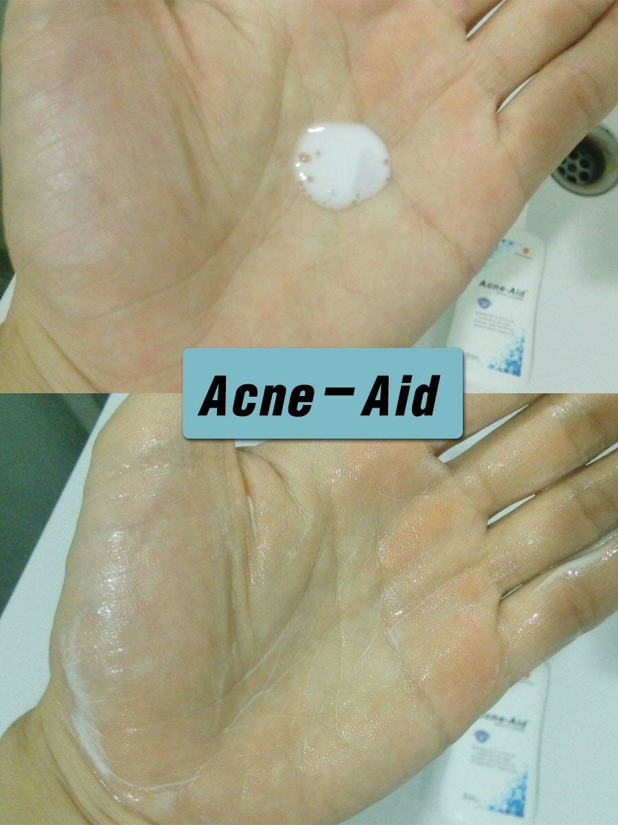 สบู่ล้างหน้าสำหรับผิวแพ้ง่าย Acne-aid gentle cleanser